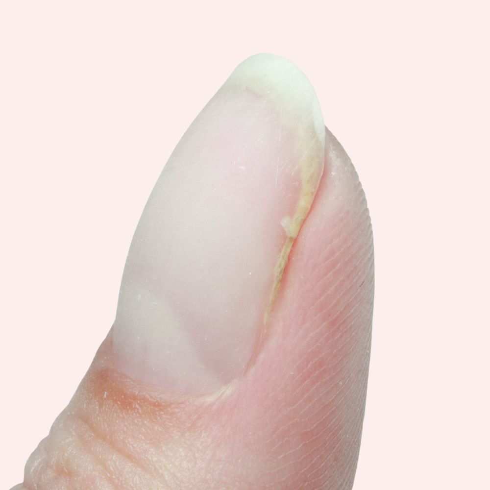 How To Fix A Broken Nail With Teabag Method Image 1