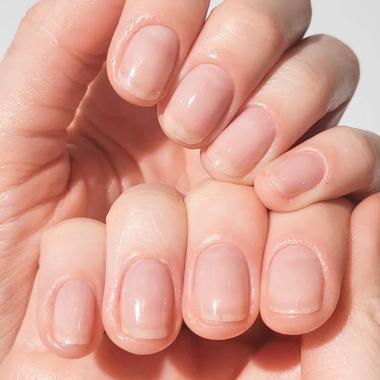 Cuticles With Dry Hand Nail Oil